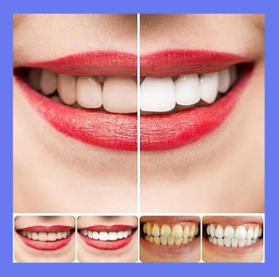 Picture of Yayashi sp-4 Probiotic Toothpaste freshen breath maintain oral health whiten teeth Stain Removing Sp-4 Toothpaste Teeth Cleaner Plaque Remove 