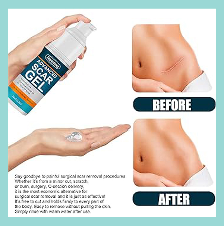Picture of 50ml Scar Removal Gel - Effective Stretch Mark, Acnes Spots, Burns and Surgical Scars Treatment Cream - Retinol, Allantoin,Vitamin E - Post Surgery Skin Repair Supplies No Side Effects 