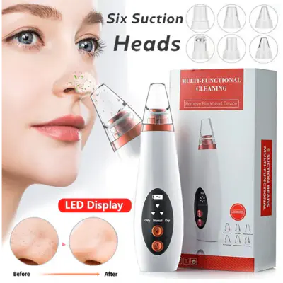 Picture of Blackhead Remover Machine Blackhead Remover Instrument Black Dot Remover Acne Vacuum Suction Face Clean Black Head Pore Cleaning Beauty Skin (Face)
