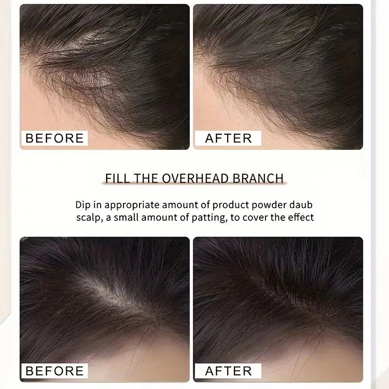 Picture of Vanlin Maydy Hairline Shadow Powder - Root Touch Up Hair Color for Gray Coverage - Bald Spot Concealing Hair Powder for Women & Men - 24-Hour Stain-Proof-Coffee